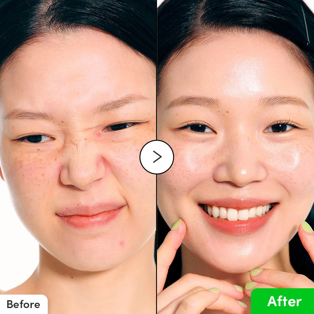 Aloe Pdrn Calming Serum 30ml/aloepdrn - MOQ 108