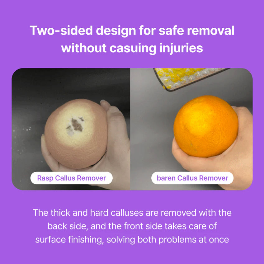 BAREN Callus Remover Magic Stainless Pro Dobule Sided Foot File