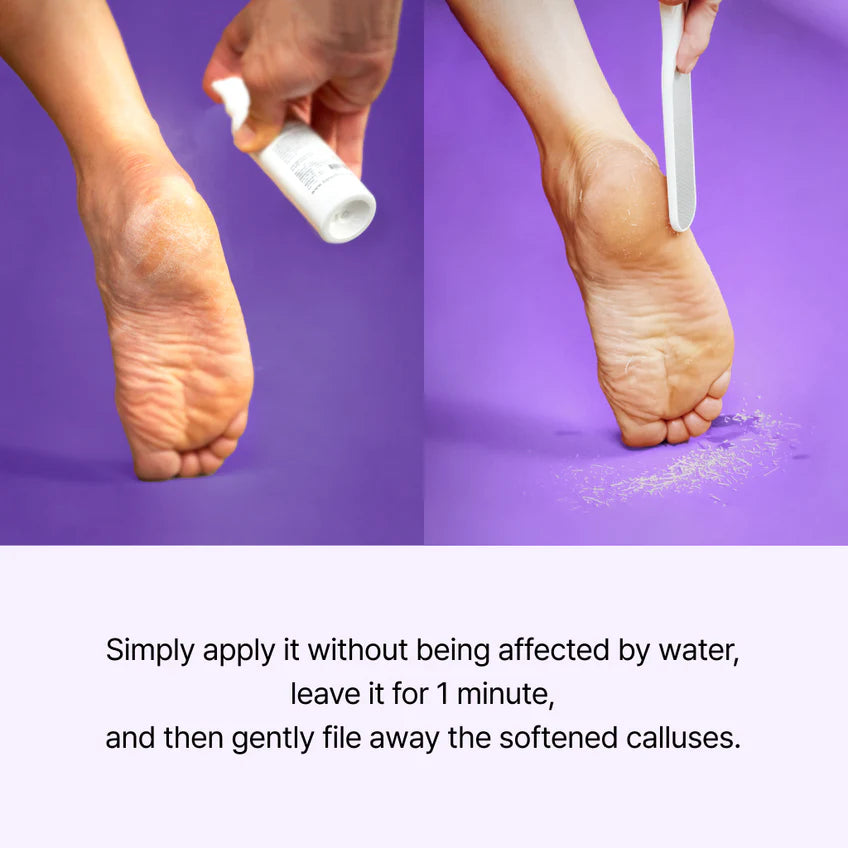 BAREN Callus Remover Peeling Foot Spray, 100ml