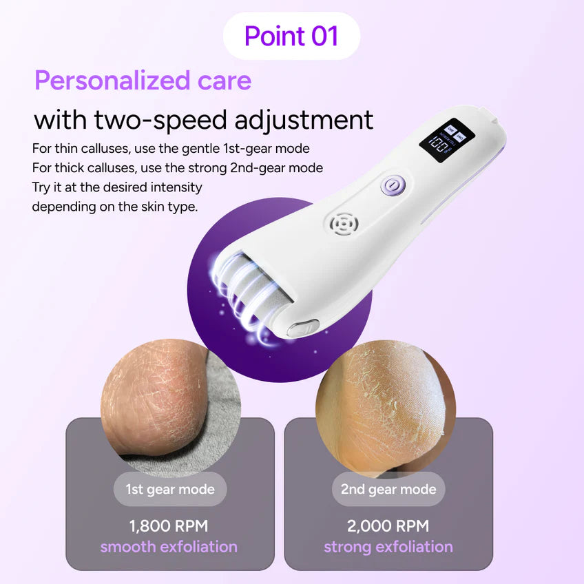 BAREN Pedi Mate Dual Power Vacuum Type Electric Callus Remover - MOQ 12
