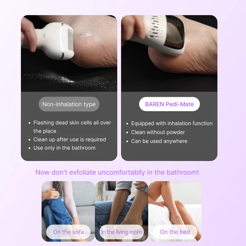 BAREN Pedi Mate Dual Power Vacuum Type Electric Callus Remover - MOQ 12