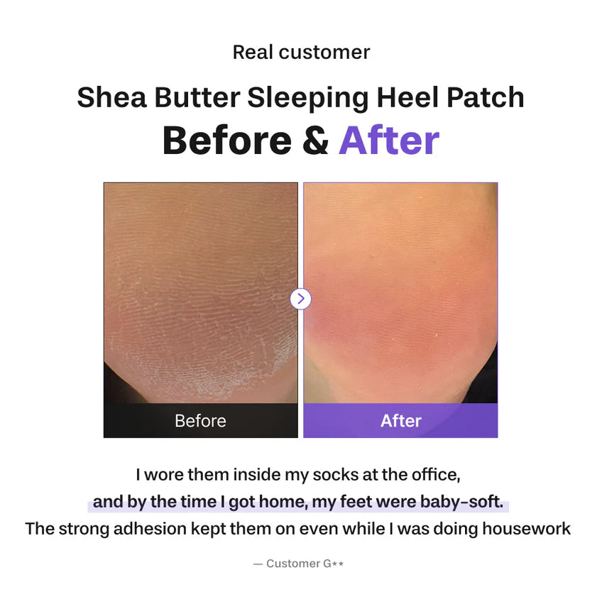 BAREN shea butter sleeping heel patch(2P)