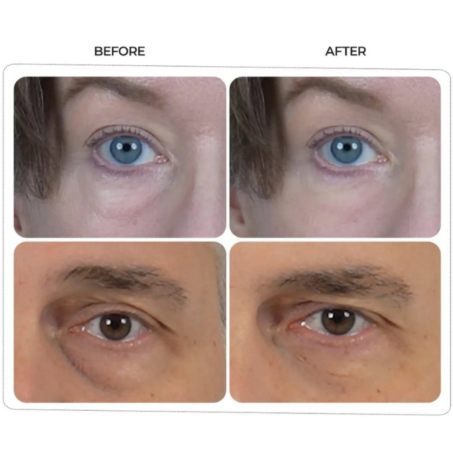 Dr.melaxin Eyephalt Eyebag Cream 10ml - MOQ 210