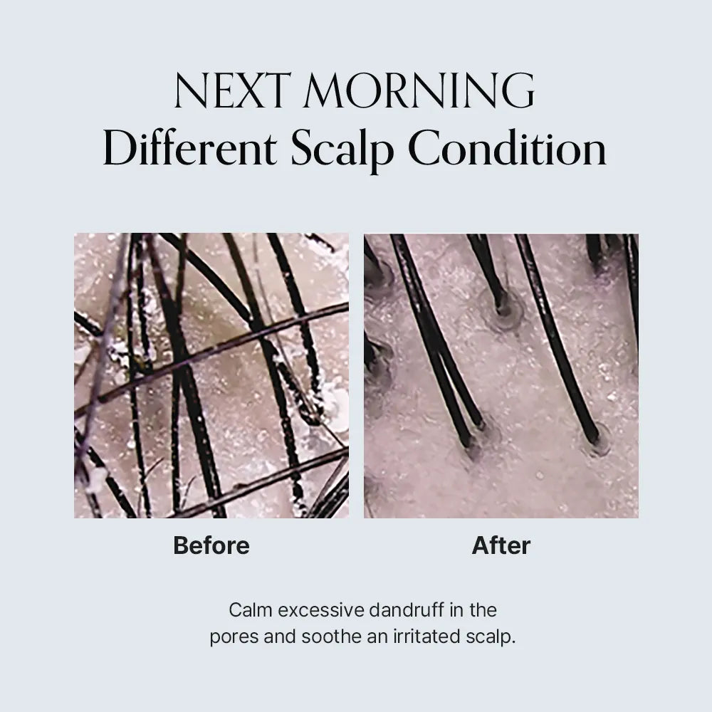 GROWUS Damage Therapy Scalp Scaling Ampoule - MOQ 80