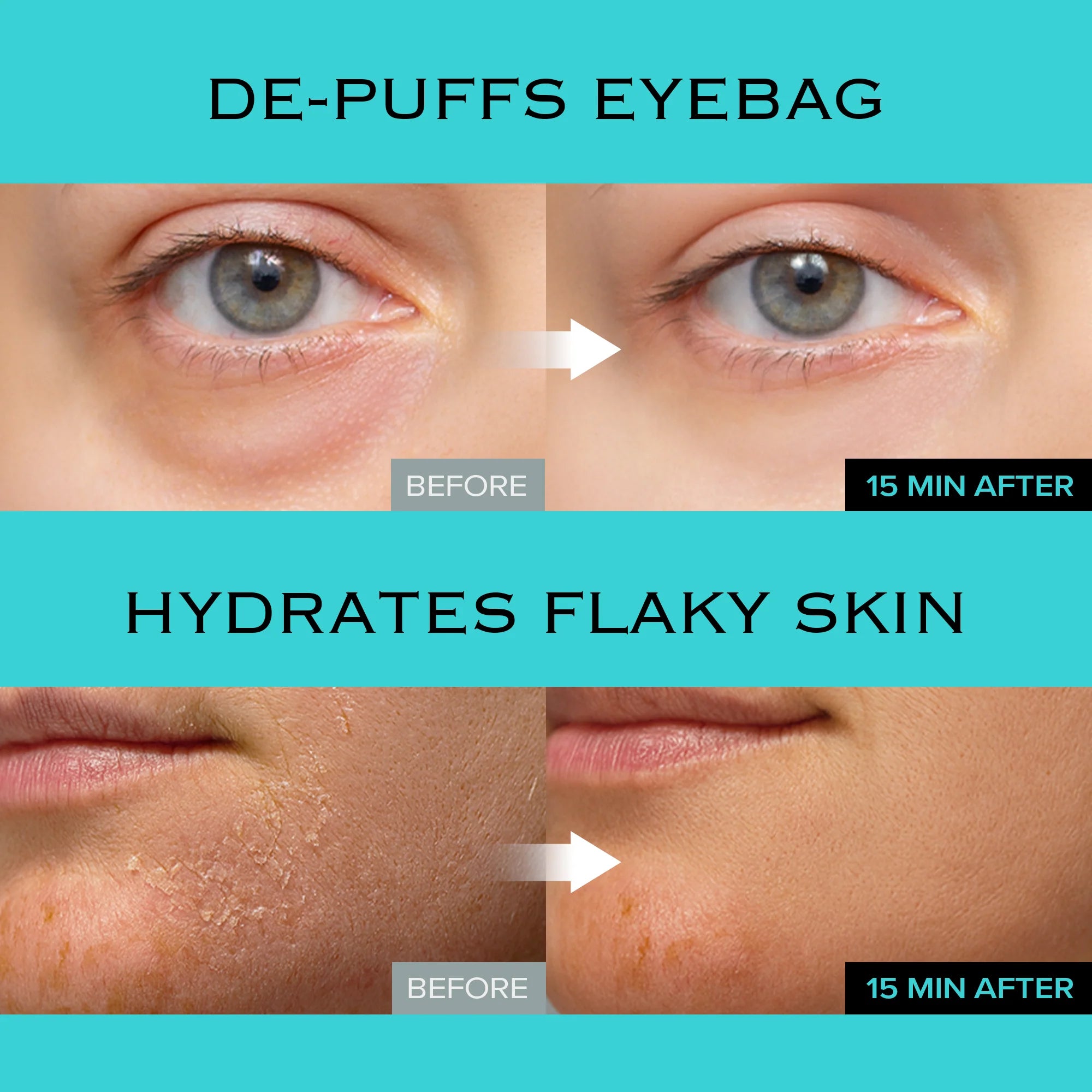 Mimumimu Icy Glacier Sherbet Pad - MOQ 50