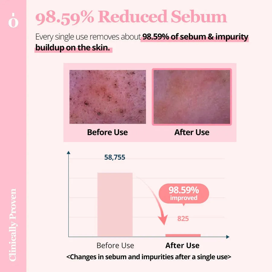 Ongredients Pore Cleansing Pad - MOQ 40.00