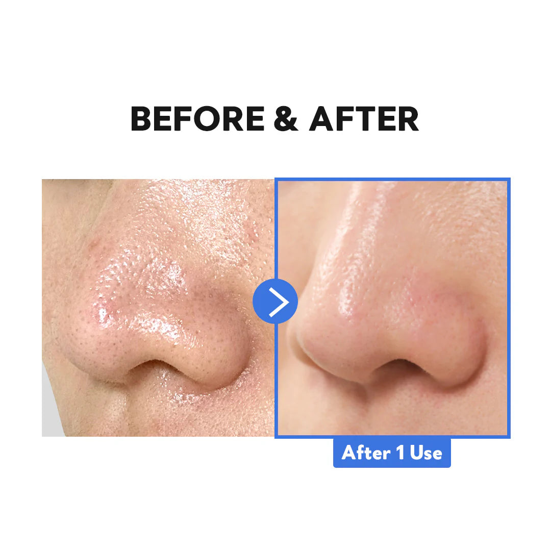 TIRTIR HYDRO BOOST ENZYME CLEANSING BALM 9ml - MOQ 180