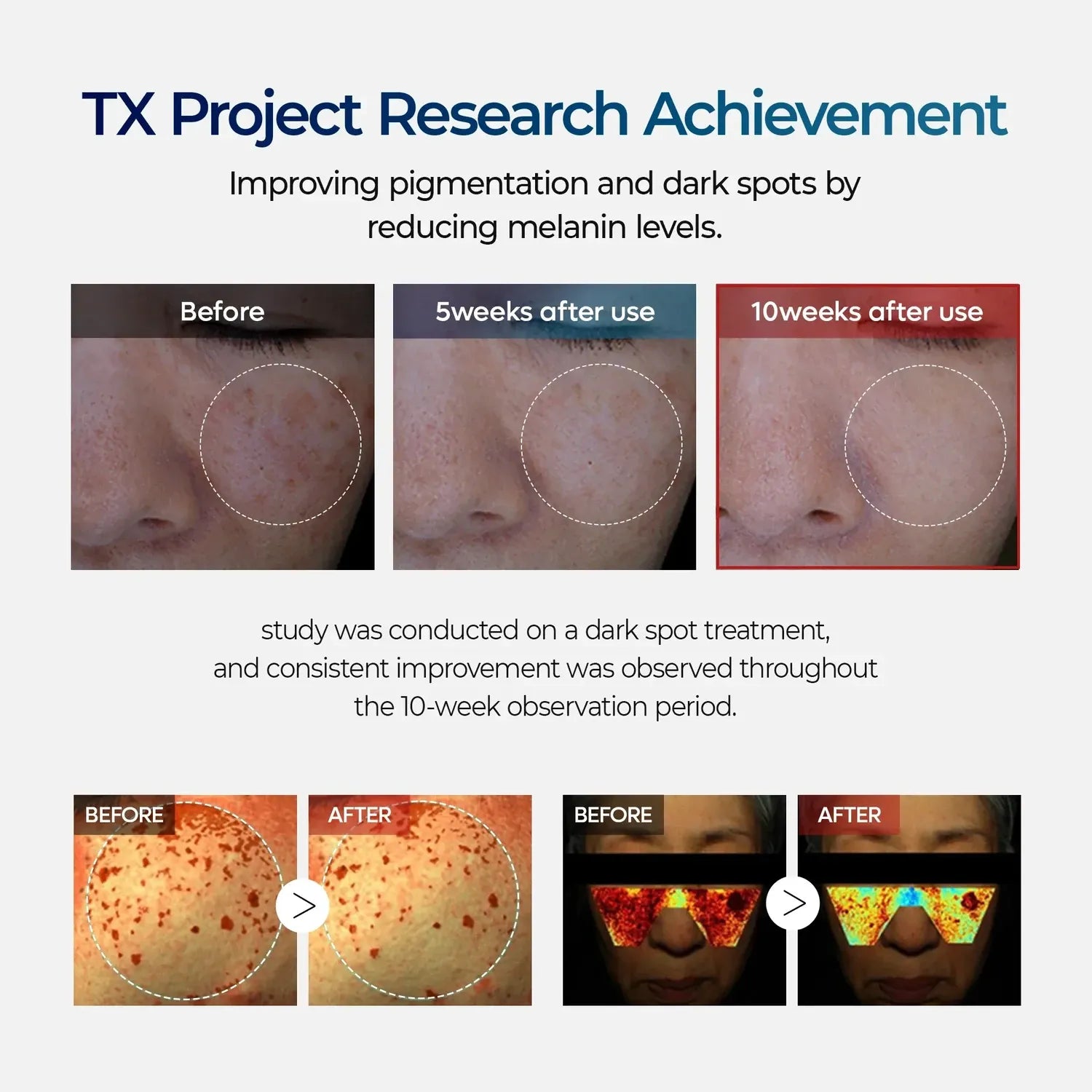 TX Ampoule 30ml - MOQ 168